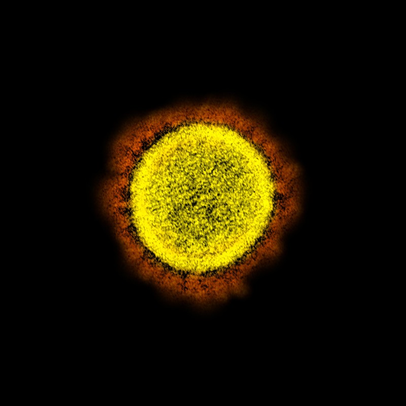 The novel coronavirus under an electron microscope.