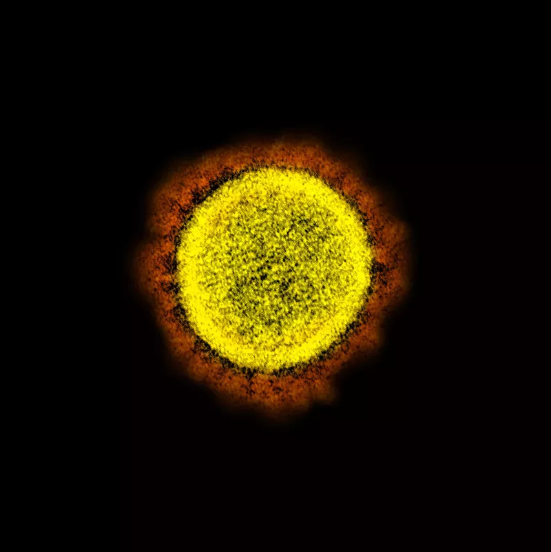 Image: The novel coronavirus under an electron microscope.