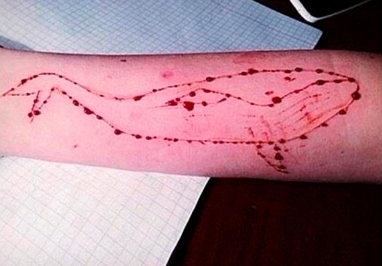 A purported photo of a blue whale cutting on someone's arm. Maricopa County Attorney Bill Montgomery warned parents on Wednesday about the alleged online game.
