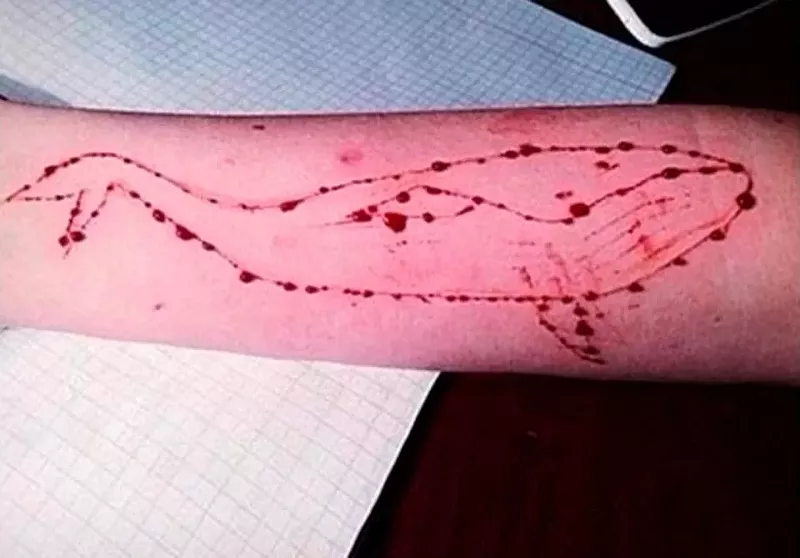 Image: A purported photo of a blue whale cutting on someone's arm. Maricopa County Attorney Bill Montgomery warned parents on Wednesday about the alleged online game.