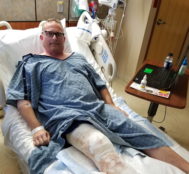 Scott Kimmel, a 49-year-old resident of Buckeye, was walking when his e-cigarette caught fire in his pants.