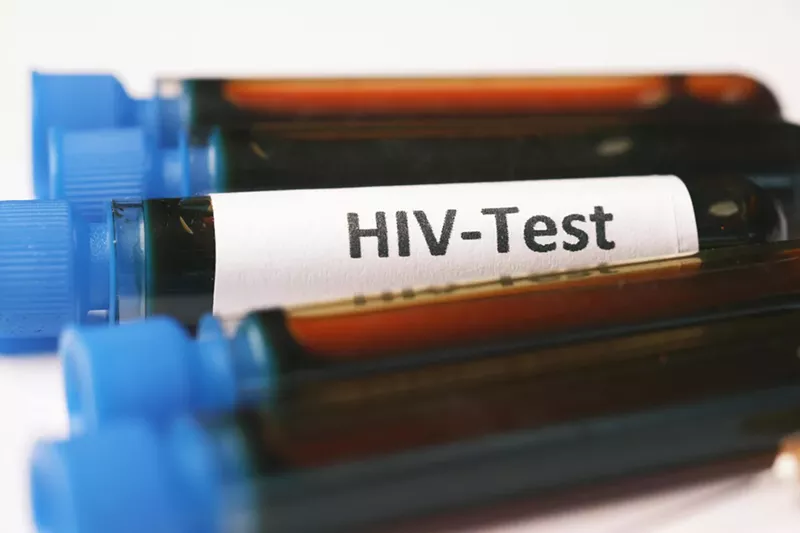 Image: Blood vials labeled "HIV-Test"