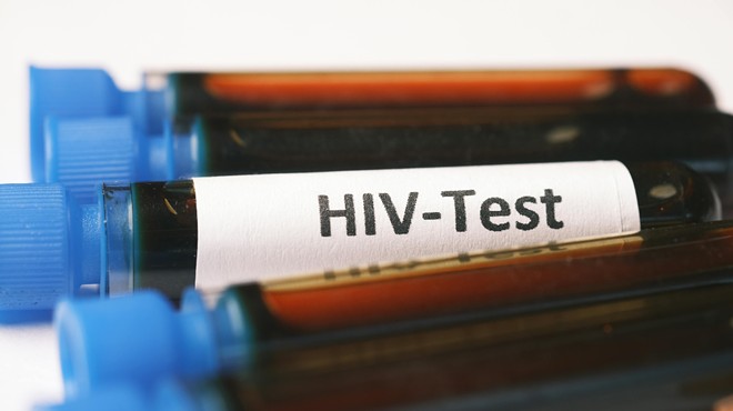 Blood vials labeled "HIV-Test"