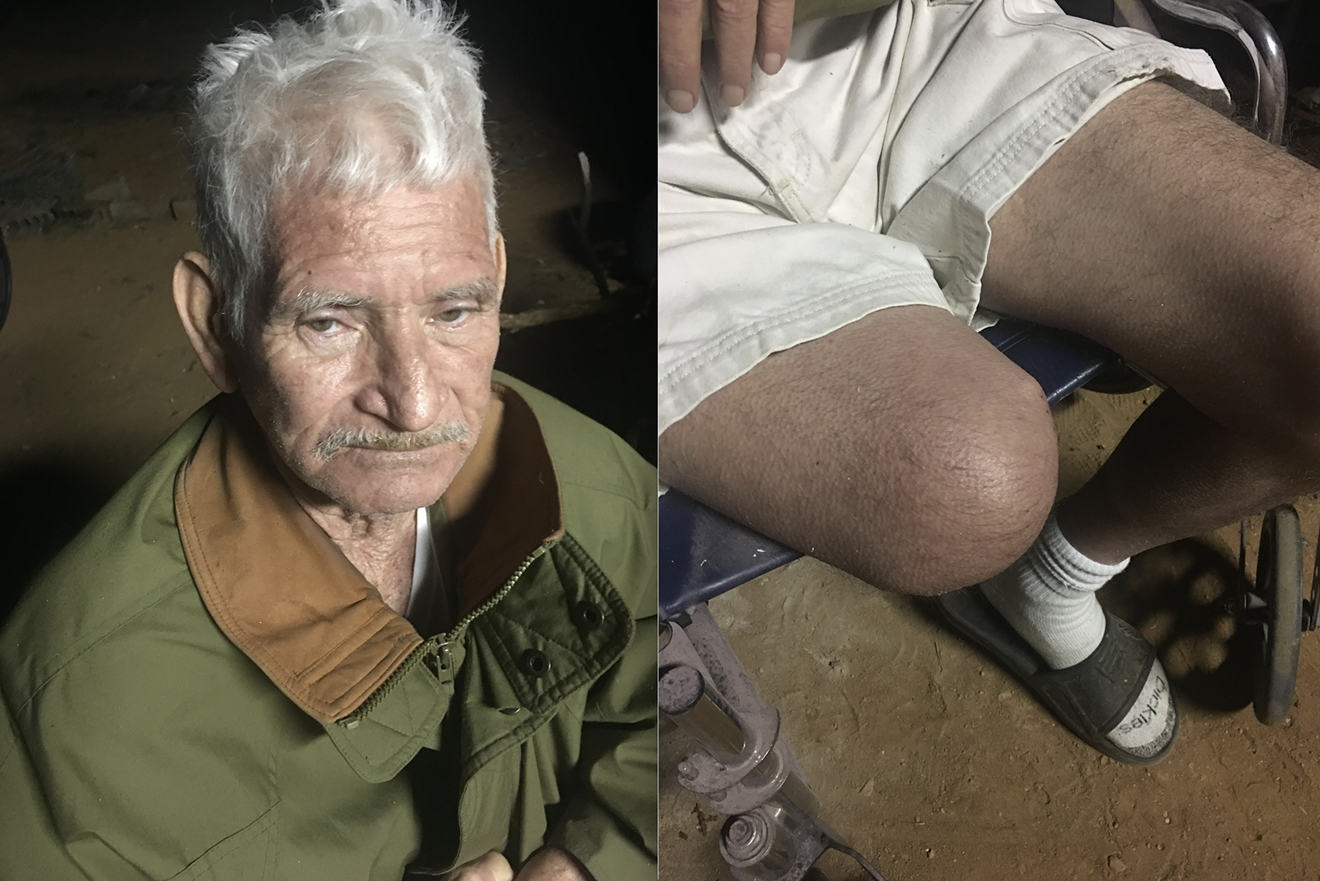 Andres Romero, 72, who eventually lost his leg after several amputations while in Cochise County Jail custody. Romero alleges the injury started with the jail's neglect of a minor toe infection, which he developed due to faulty hospital facilities.