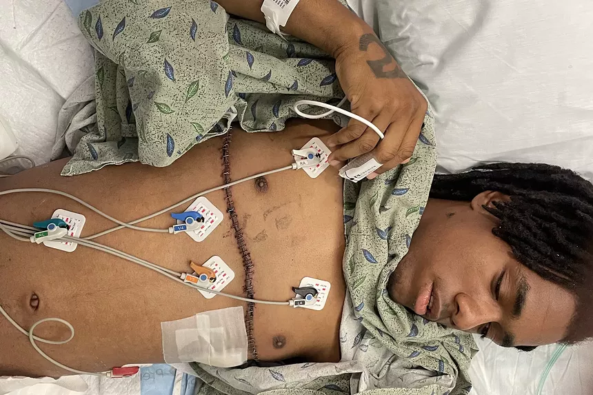 Devin Thompson gunshot wounds