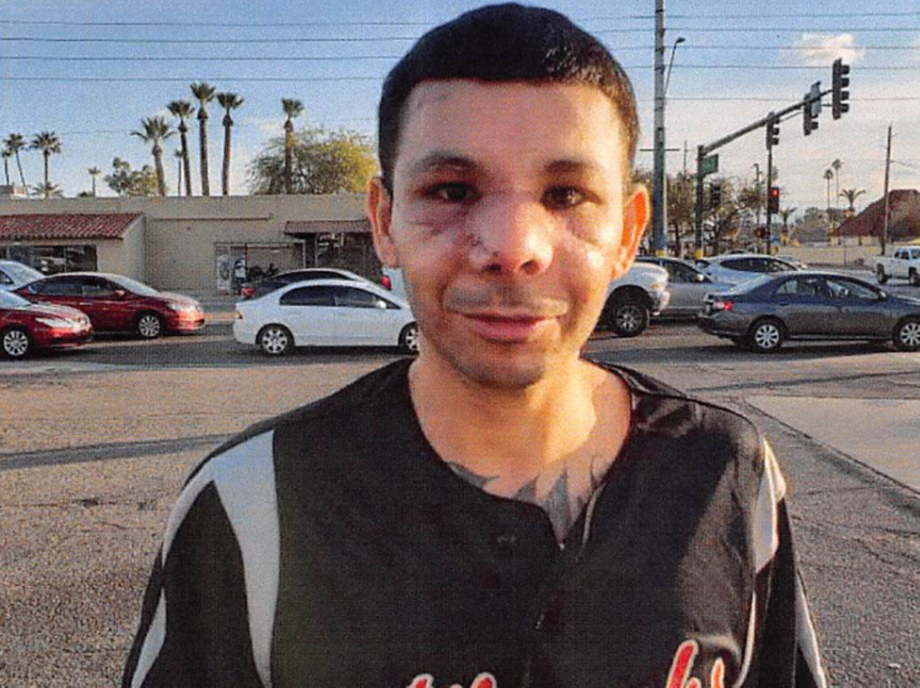 Carlos Balli was mauled by an Arizona canine officer in January.