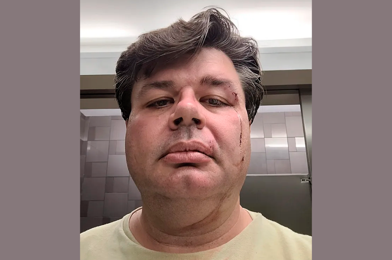 ASU professor David Boyles suffered injuries to his face after he was shoved from behind during an altercation on Oct. 11.